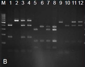 Für jeden snip-snp wurde jeweils zuerst der Verdau des N2-PCR-Produkts, gefolgt von CB4856, den ts-würmern und zuletzt die Nicht-ts-Würmer, aufgetragen.
