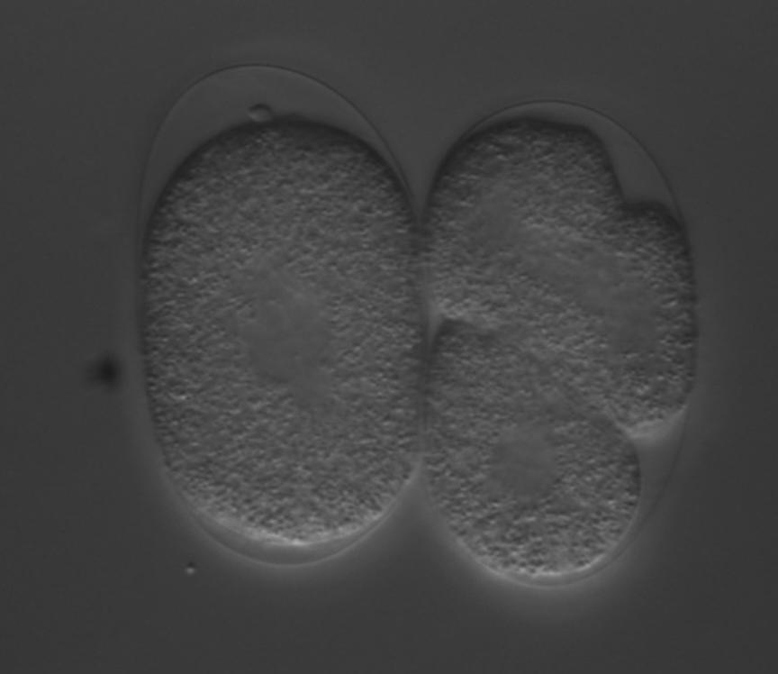 A B C D E F G H I J K Abbildung 57: Expressionsmuster von egl-5:gfp. Während der frühen Embryogenese wird egl-5::gfp nicht exprimiert (A E).
