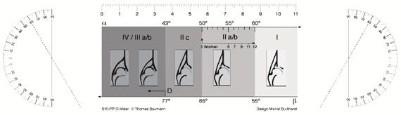 Einleitung Abbildung IX : Sonometer nach