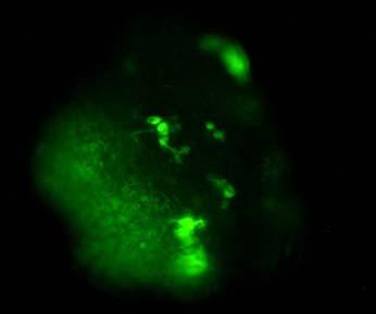 kontrolliert, welche sich durch grün fluoreszierende Zellen zeigt, als Marker für eine erfolgreiche Transfektion. A B C D Abbildung 39.
