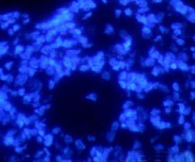 Der Nachweis der Müllerzellen kann über eine immunhistochemische Färbung