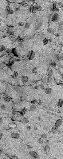 Cu-Ausscheidungen (5-20 nm) In der randschichtausgehärteten Zone ist die Ausscheidungsdichte