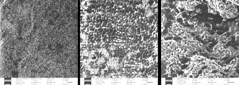 Elektronenmikroskopische Untersuchung der Biofilme auf zwei unterschiedlichen Oberflächen Abbildung 64 Natürlich gesunder Biofilm von E. faecalis.