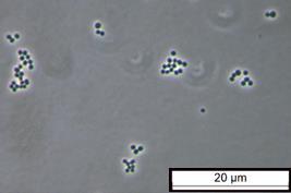 Enterokokken Abbildung 9 Hellfeldaufnahme einer Übernachtkultur von S. aureus DSM 1104 in MH Medium. Aufgenommen wurde bei 1000-facher Vergrößerung und der Maßstab beträgt 20 µm.