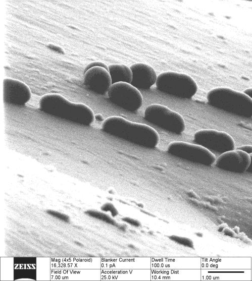 Enterokokken Abbildung 10 Aufnahme von E. faecalis DSM 2570. Das linke Bild zeigt ein Bild aus dem Helium- Ionen Mikroskop mit der Vergrößerung 16000 und der Maßstab beträgt 1 µm.