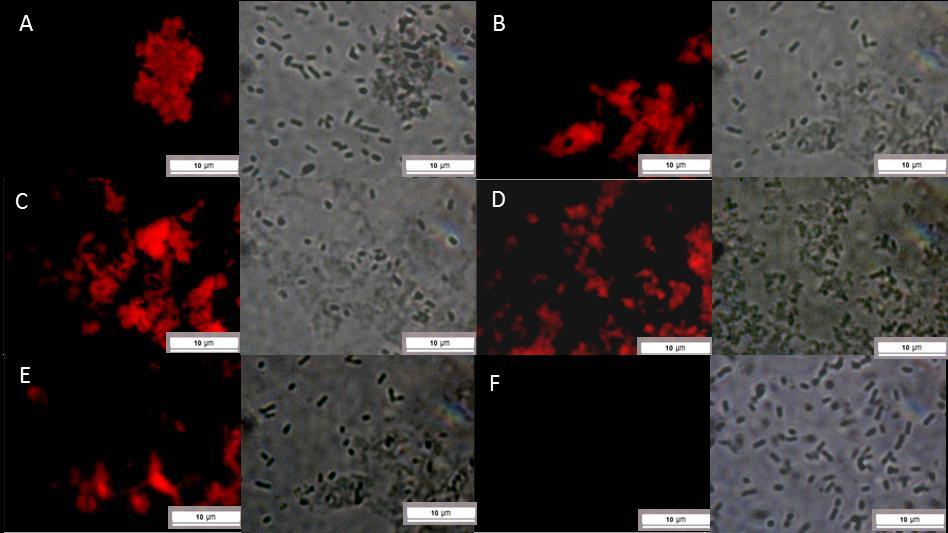 Fluoreszenzmikroskopie und die Rolle der edna bei peptidinduzierten Biofilmen Abbildung 39 TisB-behandelter E. coli, angefärbt mit DDAO.