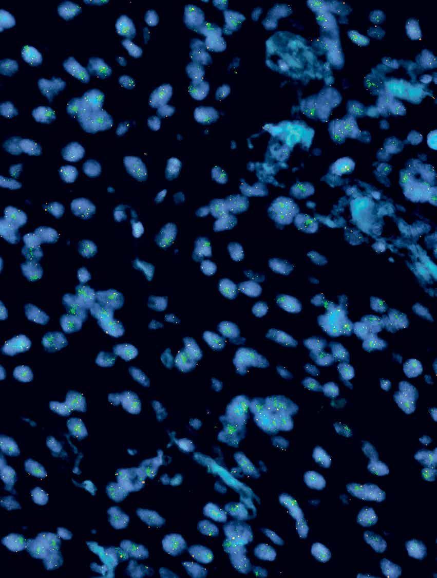 Text: Wolfgang Heumer Unter dem hochauflösenden Mikros - kop (siehe Bild) sind in einer Gewebeprobe blaue Schemen zu erkennen, auf denen vereinzelt kleine grüne Punkte leuchten.