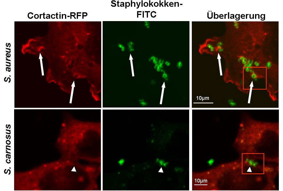 4 FUNKTIONELLE VERBINDUNG ZWISCHEN FAK UND CORTACTIN 72 A B Abb 4.17 Cortactin wird zum Invasionsort von S. aureus rekrutiert.