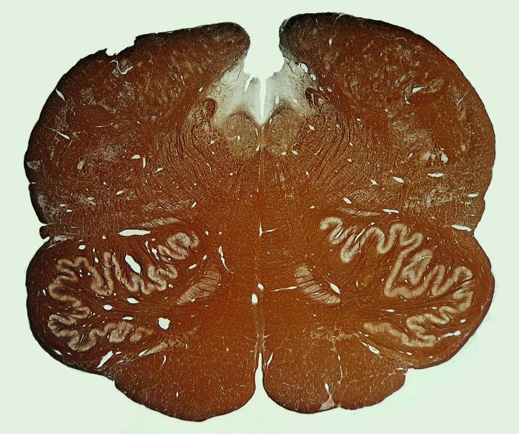 Medulla oblongata - Übersicht (Markscheidenversilberung nach Gallyas) 4 5 6 7 Tractus pyramidalis Nucleus olivaris inferior