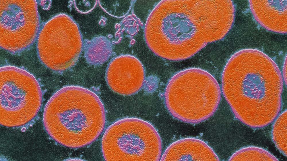 Seite 3 von 5 Streptococcus pneumoniae (Bild: Keystone) Allein in Europa sterben pro Jahr 25 000 Menschen wegen Antibiotika-resistenten Bakterien, in den meisten Fällen entsteht die Resistenz durch