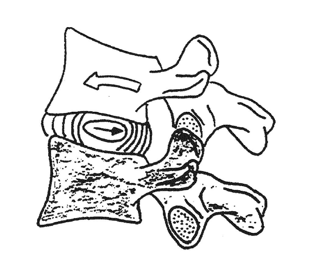 Wirbelsäule Segment LWS von dorsal Ventralflexion (= Flexion) Dorsalflexion (= Extension) Seitenneigung BWS Foramen intervertebrale Foramen vertebrale