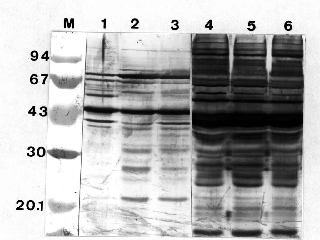 3. ERGEBNISSE 43 Tab.3 Vorhandene Banden von C. trachomatis unter dem Einfluß von 1. CMGA, 2. DFA 200 µm, 3. FeCl3 100 µm DFA 200 µm auf BGM-und HEp-2-Zellen.