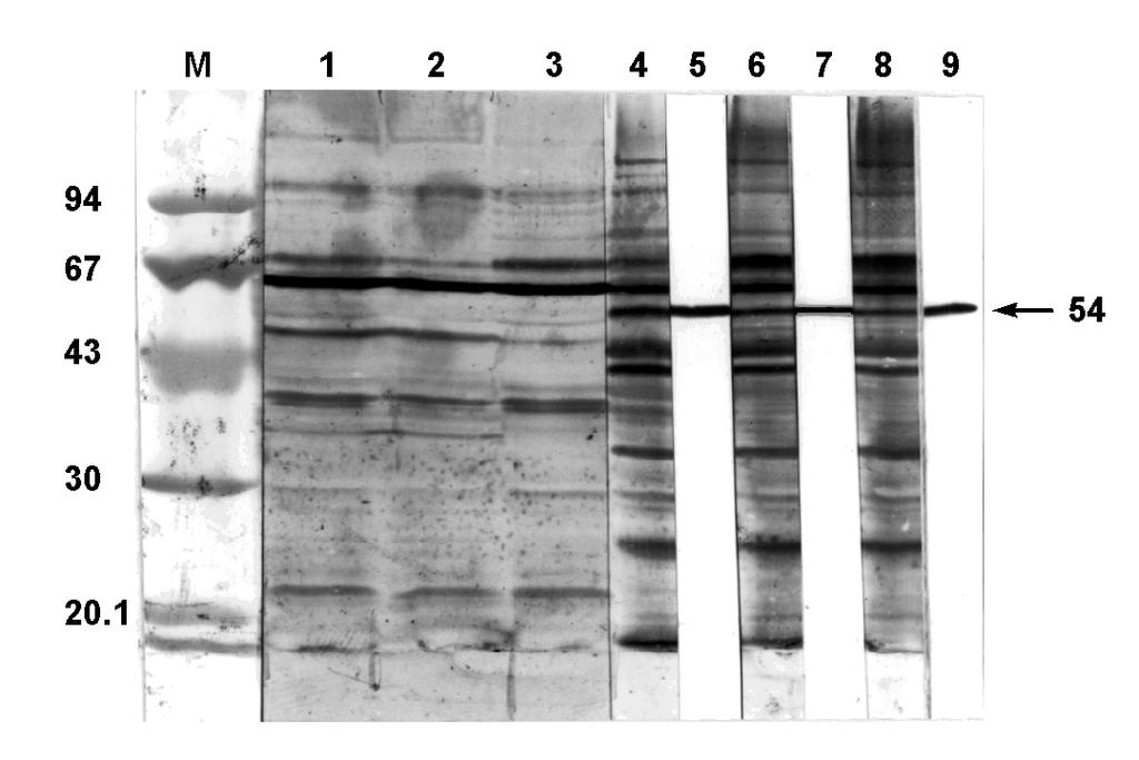 3. ERGEBNISSE 45 Tab.4: Vorhandene Banden von C. pneumoniae unter dem Einfluß von 1. ohne DFA, 2. DFA 200 µm, 3. FeCl 3 100 µm 200 µm DFA mit BGM und HEp-2-Zellen.