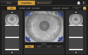 CA-800 - Hornhauttopograph Aufnahmen Der CA-800 ist einfach zu bedienen. Die visuelle Augenführung ermöglicht eine schnelle und einfache Ausrichtung und Scharfeinstellung des Auges.