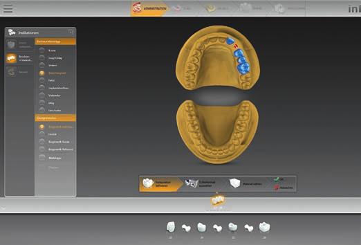 03 Abb. 1 Abb. 2 Zunächst wurde in der inlab-cad-sw 16.