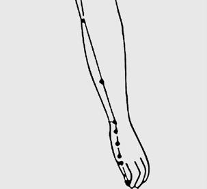 jverlauf Der Dünndarm-Meridian beginnt am ulnaren Nagelfalzwinkel des Kleinfingers und zieht dann über dessen Außenseite über die Handkante und die ulnare Unterarmseite zum dorsalen Oberarmbereich.