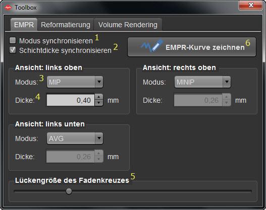 Plugin: EMPR, 3D 161 Übersicht: EMPR Toolbox Element Beschreibung 1 Modus synchronisieren - aktivieren Sie diese Option um den gleichen Darstellungsmodus für alle EMPR-Bildbereiche zu verwenden.