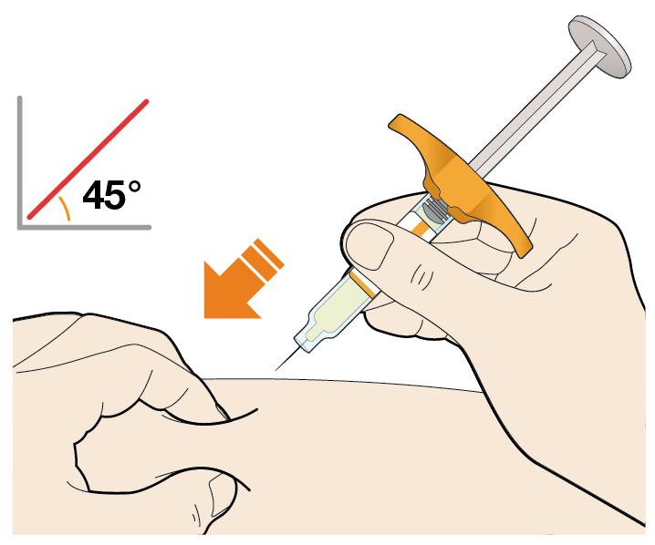 3. Stechen Sie die Nadel in einem Winkel von etwa 45 in die Hautfalte ein. 4. Drücken Sie den Kolben nach unten.