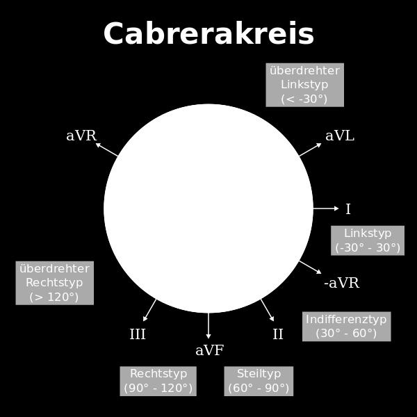 Ruhe-EKG nach Cabrera Die Anordnung der EKG-Kurven auf einem Ruhe-EKG-Ausdruck können nach Cabrera (avl, I, -avr, II, avf, III, V1-V6) ausgedruckt