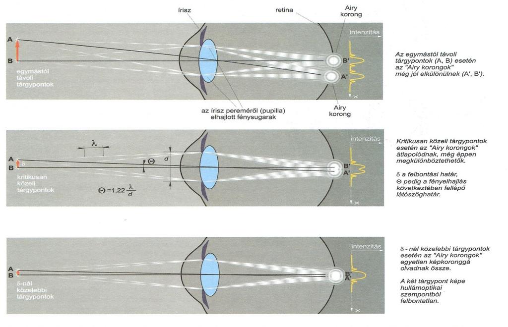 Damjanovich Fidy- Szöllősi Optisches Auflösungsvermögen des Auges Zwei Punktquellen können gerade noch aufgelöst werden, wenn sich das Zentrum der einen Airy-Scheibe einer Quelle im ersten dunklen
