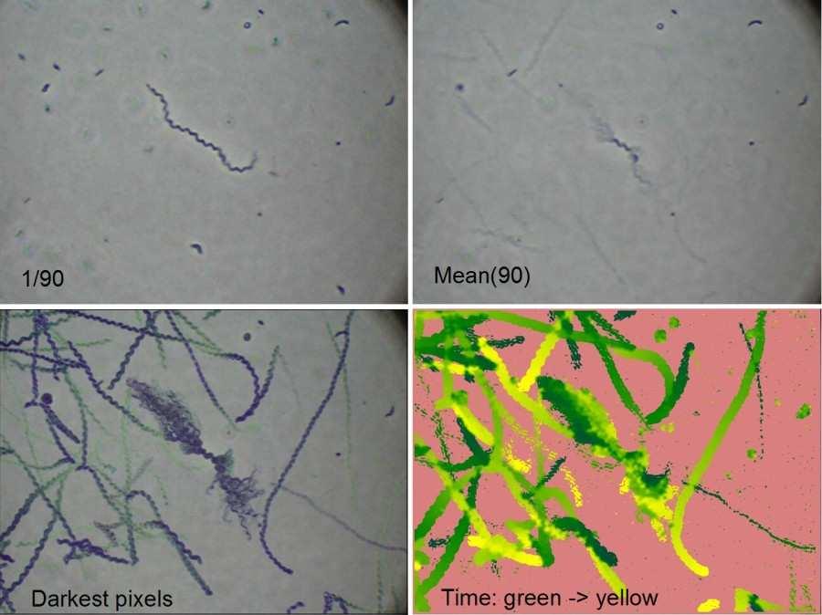 Movement analysis by means of PICOLAY Morphologie Achromatium