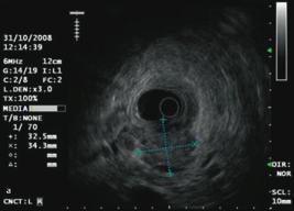 3 MRT Techniken, Messprotokolle und praktisches Vorgehen Der Einsatz schneller Gradientenecho-(GRE-) Sequenzen und Single-Shot-Sequenzen hat die abdominelle MRT Diagnostik maßgeblich geprägt.