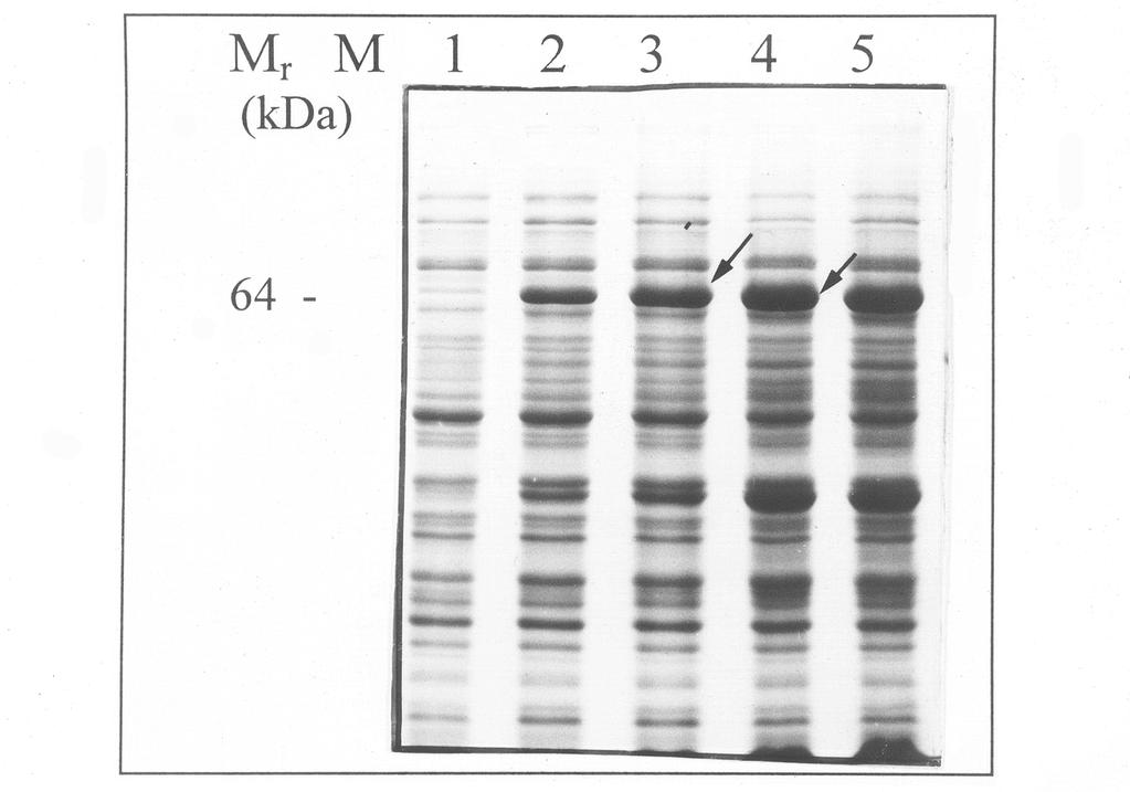 3. Ergebnisse 3.2 Überexpression und Aufreinigung des Glutathion S-Transferase-Pex14p im E. coli-stamm BL21 (DE3) 3.2.1 Expression und Reinigung des Fusionsproteins GST-Pex14p Bei dem Stamm BL21 handelt es sich um einen Protease-defizienten E.