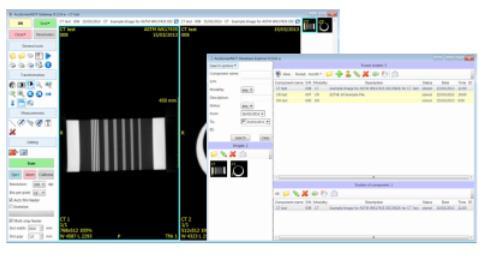 Unsere Ingenieure haben die AcuScreen NDT-Software speziell entwickelt, um das Digitalisieren von analogen Röntgenfilmen einfach, schnell, intuitiv und in höchstmöglicher Qualität ausführen zu können.