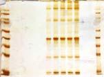Blutfarbstoff MW ~ 62 000 Da (ohne Hämgruppe) 574 Aminosäuren Fe-hältige