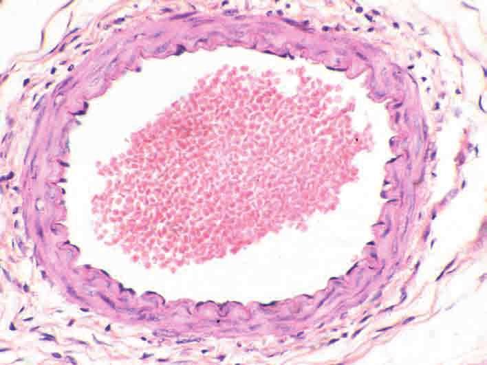 Arterie Lamina endothelialis der Tunica interna mit schwacher dünnwandige Tunica media Tunica