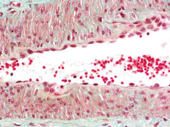 Tunica media mit glatten Muskelzellen (Längsschnitt) Flachschnitt durch Endothelzellen Lamina