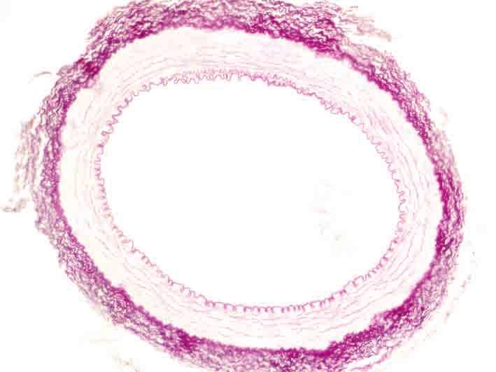 Arterie elastische Fasern der Tunica media Membrana elastica externa Arterie, Rind.