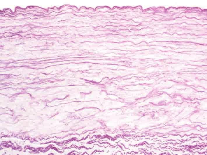 elastische Fasern der Tunica media Membrana elastica externa Arterie, Pferd.