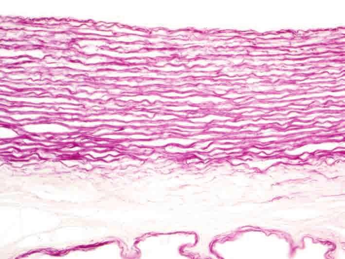Arterie relativ schmale elastische Fasern in lamellärer Schichtung (Tunica media) außen anliegendes lockeres