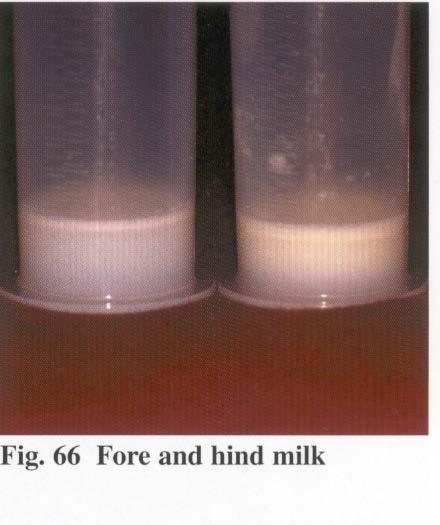 Die Fette der Muttermilch Menge in 100 ml MM 4.3g / KM 3.7g / SN 3.
