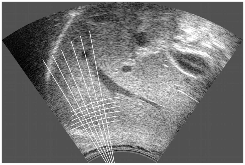 2 Datenaufnahme und Extraktion der Parameter Abbildung 2.4: Darstellung der Unterteilung des Ultraschallbildes in ROIs näher beschrieben.