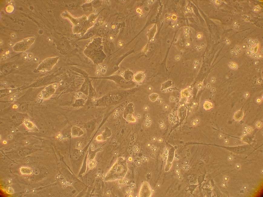 Abb.4: ES- Zellen (embryonale Stammzellen); 0 Tage alt;