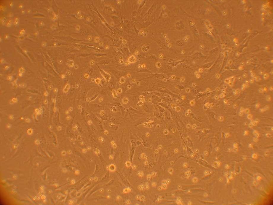Abb. 3: MEF Zellen (mouse-embryonic-fibroblast) als dienen im Experiment