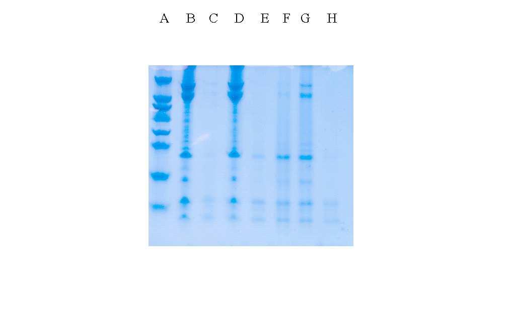 Abb. 7: SDS-PAGE von Proteinen aus aldehyd-exponierten Wollen.