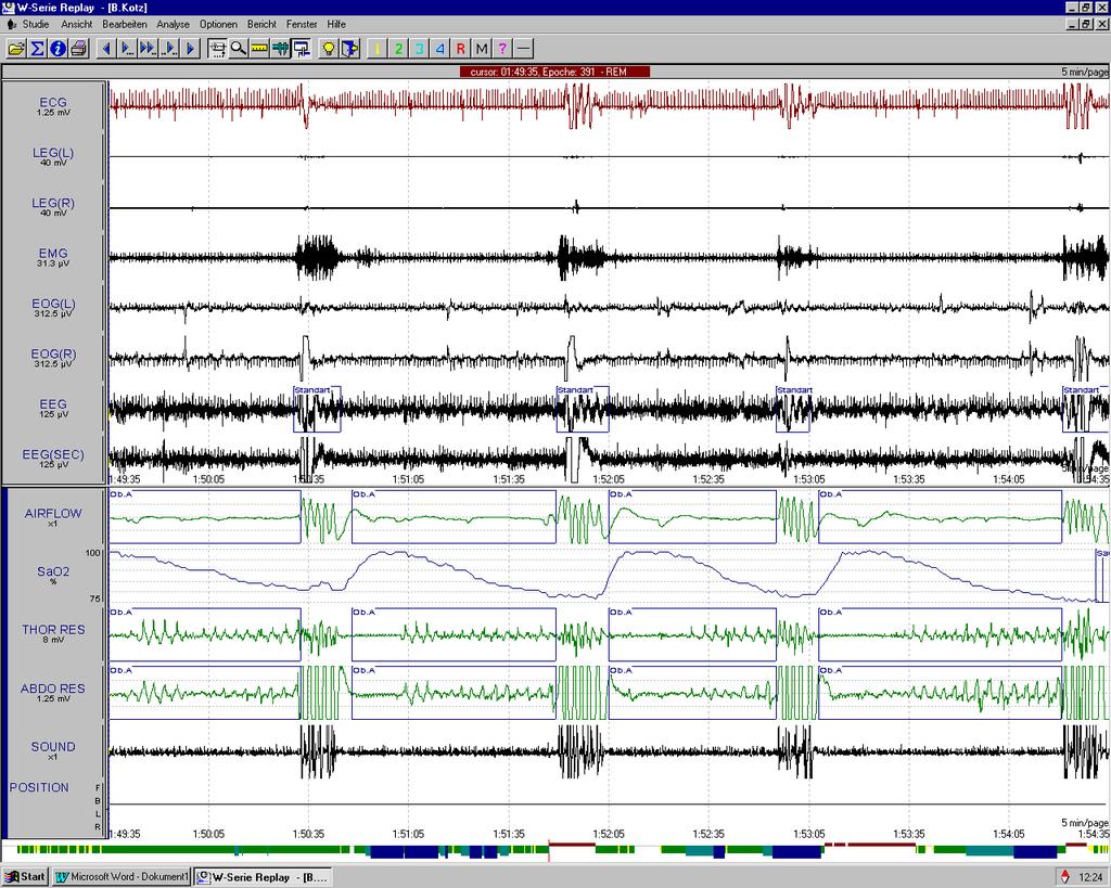 EMG EEG airflow O2
