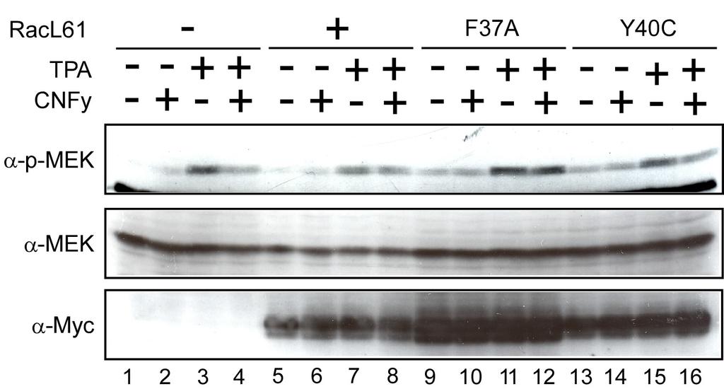 4 Ergebnisse transfiziert, mit SDF-1α vorbehandelt und anschließend mit TPA stimuliert. In den Zell-Lysaten wurde die MEK-Aktivität mittels SDS-PAGE und nachfolgendem Western Blot analysiert.