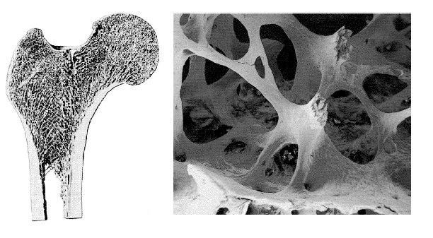 Stufe 6: Kompakter und spongioser Knochen Struktur a Leichtbaustruktur