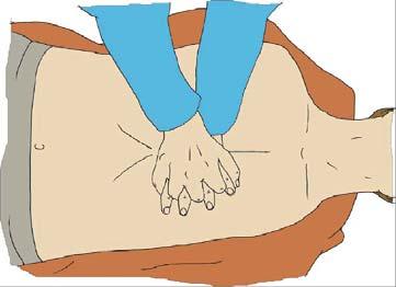 Herz-Druck-Massage Druckpunkt Mitte des Thorax Eindrücktiefe