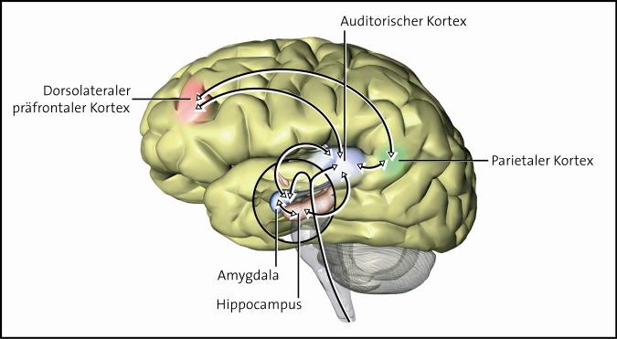 Tinnitus geht mit neuroplastischen Veränderungen im zentralen