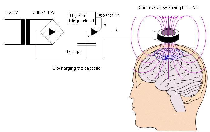 Transkranielle Magnetstimulation (TMS) Prinzip der elektromagnetischen Induktion: Das entstehende Magnetfeld durchdringt die Schädelkalotte nahezu