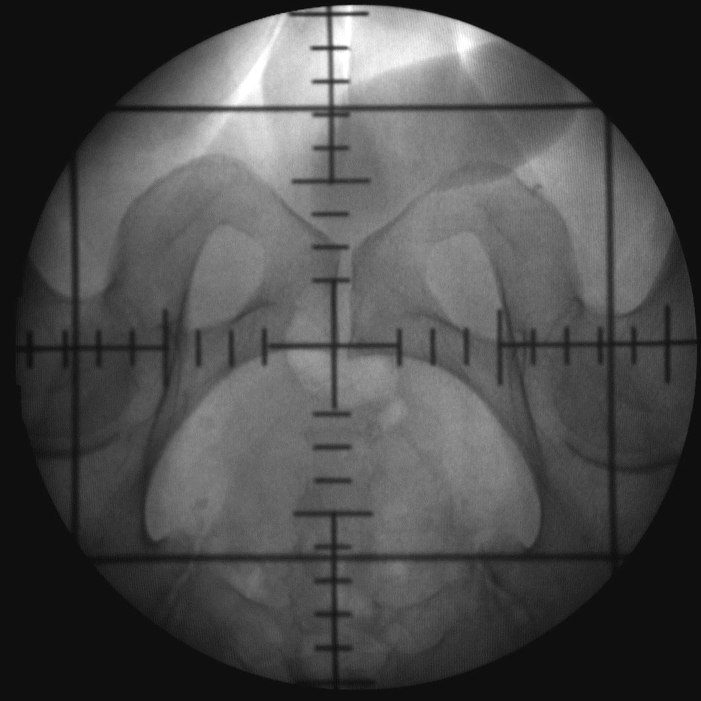 Patienten - QA Routine-QA: Bestrahlungsfelder Behandlungs- Plan MU