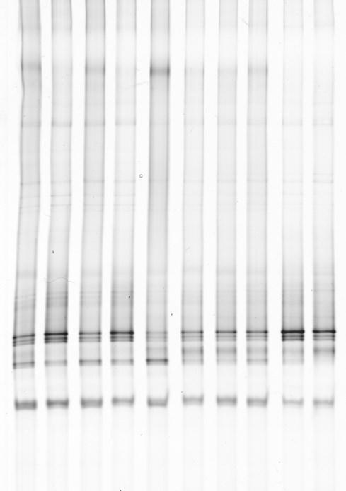 Day -10-4 0 15 19 24 27 30 39 41 6 8 7 Figure 8: Comparative DGGE-analysis of methanogenic archaeal 16S rrna gene fragments DNA from sludge samples taken on several days during the increase in OLR.