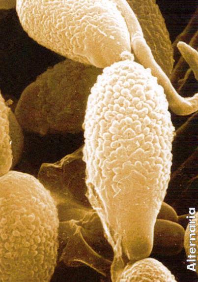Einführung Schimmelpilze gehören zu den Einzellern oder Wenigzellern sind Mikroben ( Mikrobiologie) -