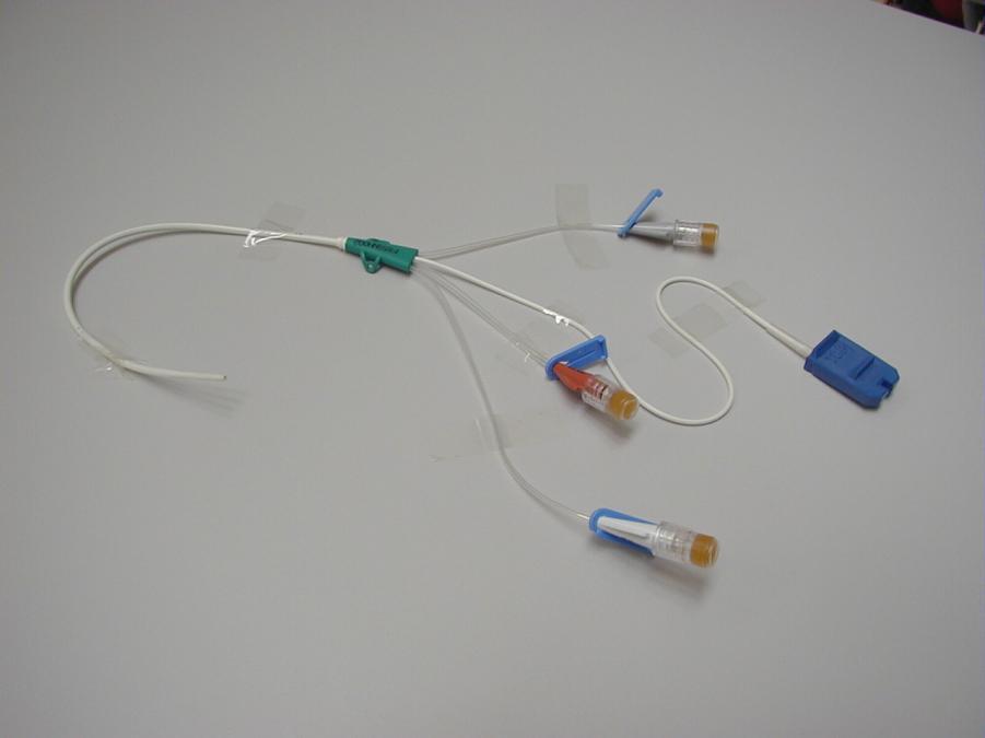 2.2 Geräte Bei der Untersuchung kam ein fiberoptischer zentralvenöser Oximetrie- Katheter (Edwards Lifesciences, Unterschleißheim) zum Einsatz (Abb. 4).