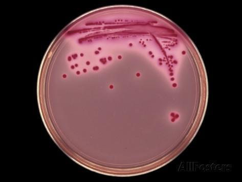 ESBL kommen vor allem in Darm-Bakterien der Familie Enterobacteriaceae (z.b. Escherichia coli und Klebsiella spp.) vor.